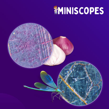 The Miniscope